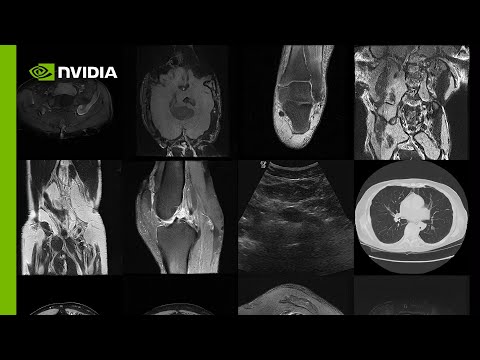 Create Infinite Medical Imaging Data with Generative AI